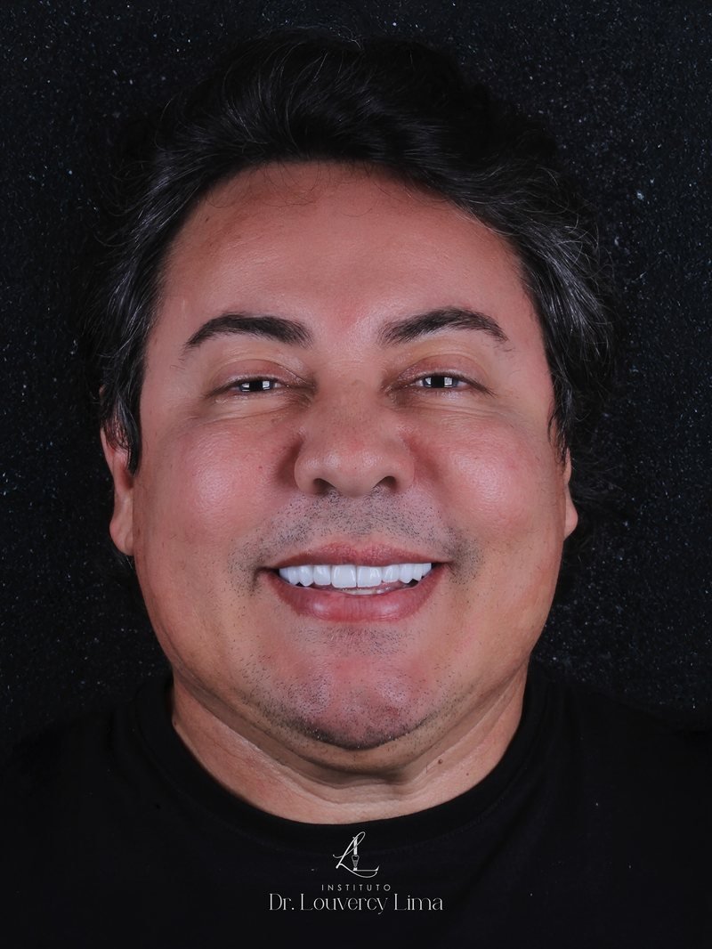 Daniel Diau, cantor